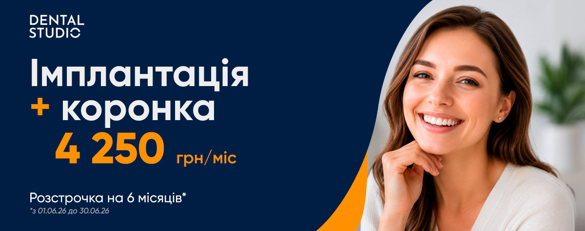 Импл UA